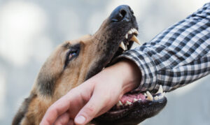 Why Choose the Law Office of William J. Tinning, P.C. for Help After a Dog Bite Injury in Corpus Christi, TX?